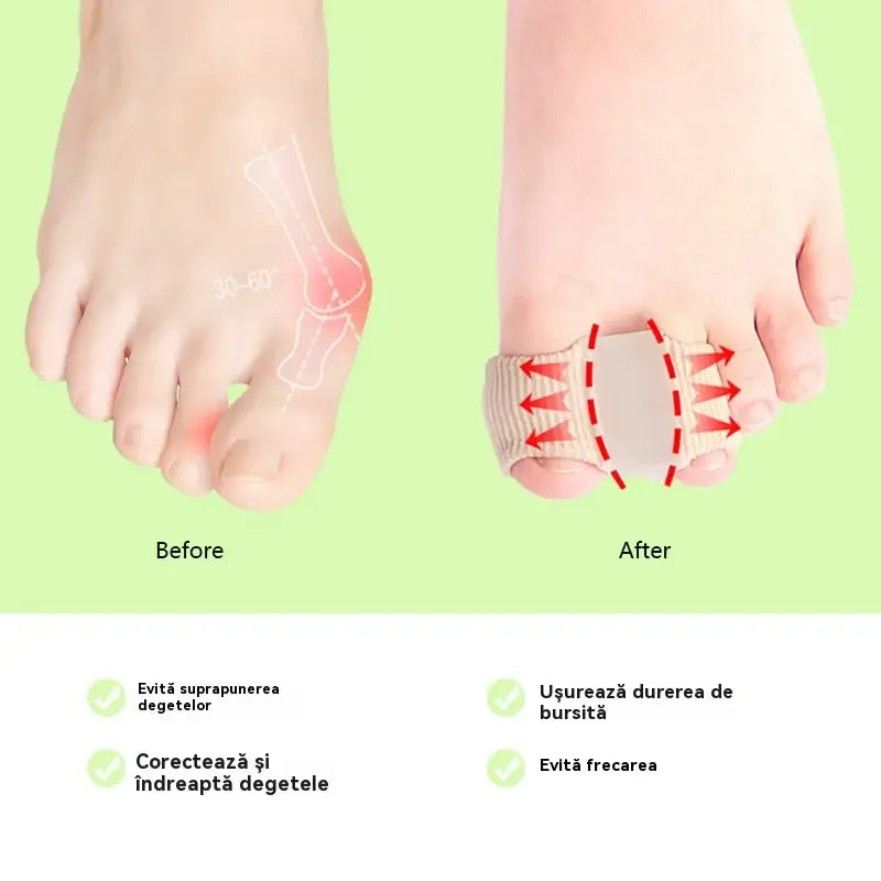 Corector Hallux Valgus(Monturi) cu separator degete