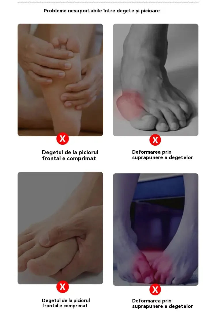 Corector Hallux Valgus(Monturi) cu separator degete